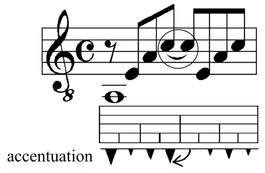 Example of a syncope